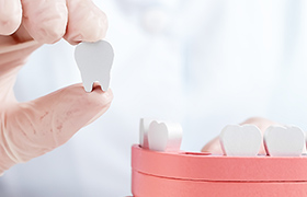 歯牙移植治療